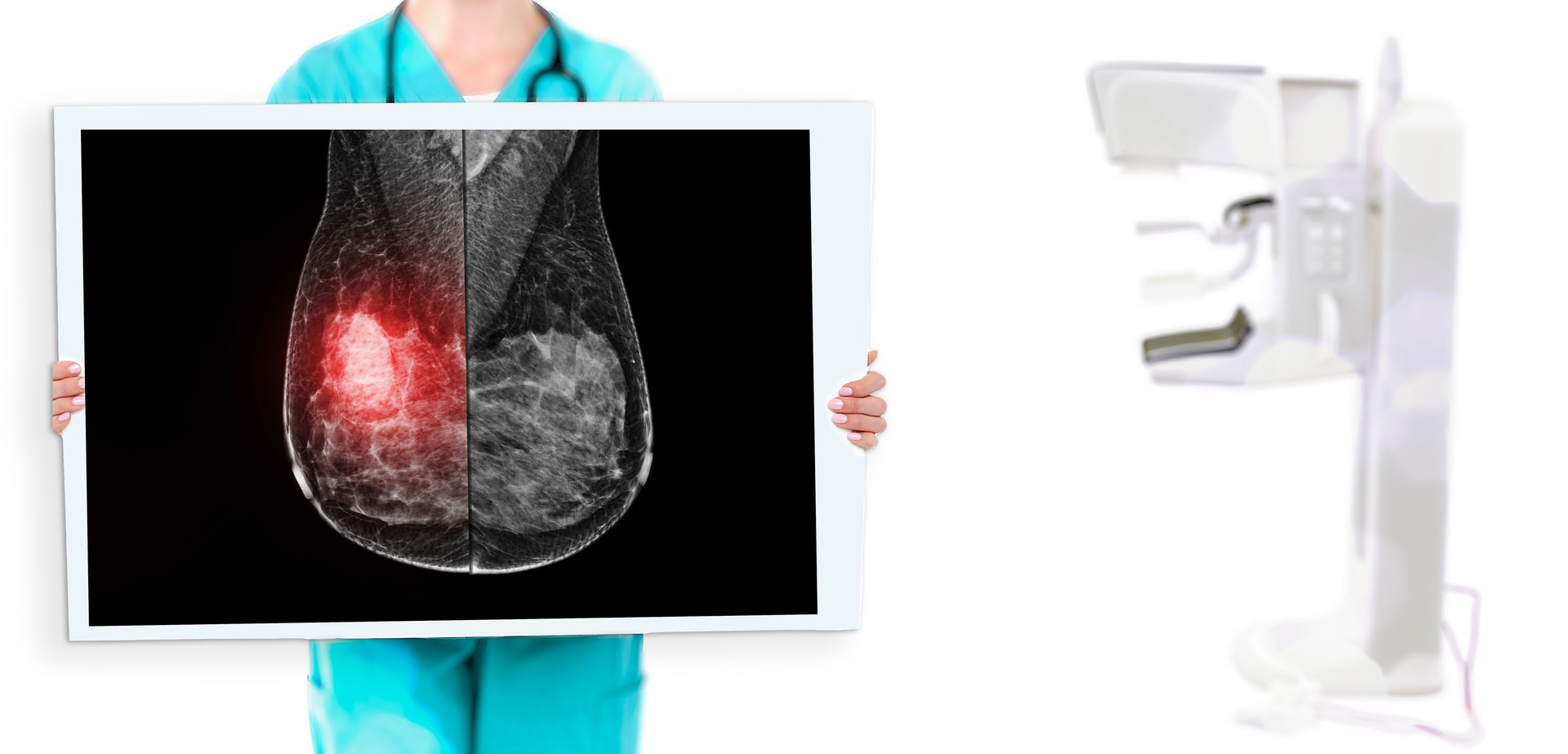 Selective focus  female doctor show  Mammogram  imaging with mammogram device in hospital.